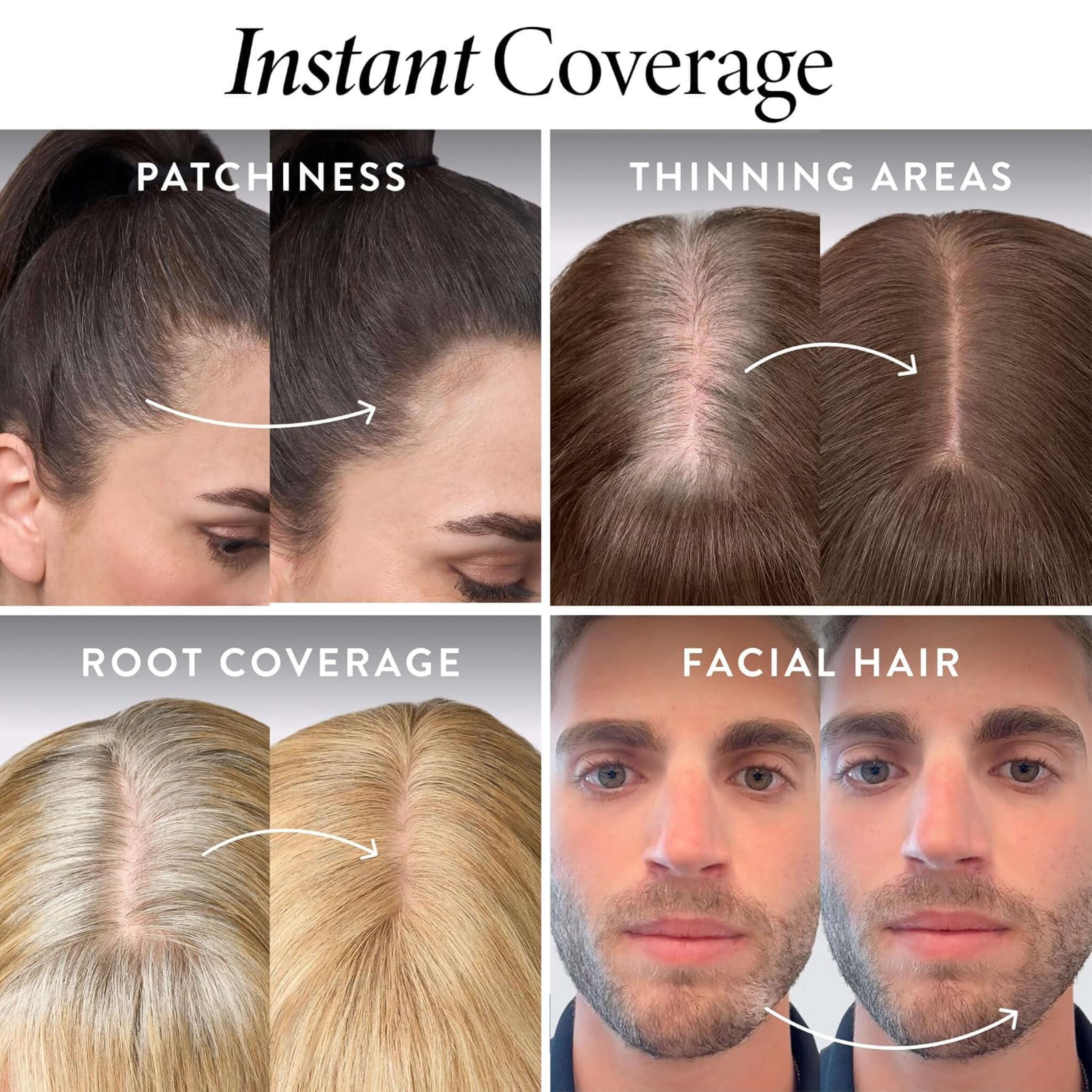 SilkRoot™ – Der smarte Haar-Touch-up-Stift