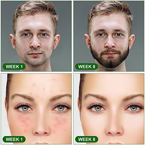 SkinPen™ - afbeelding 6
