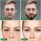 SkinPen™ - afbeelding 6