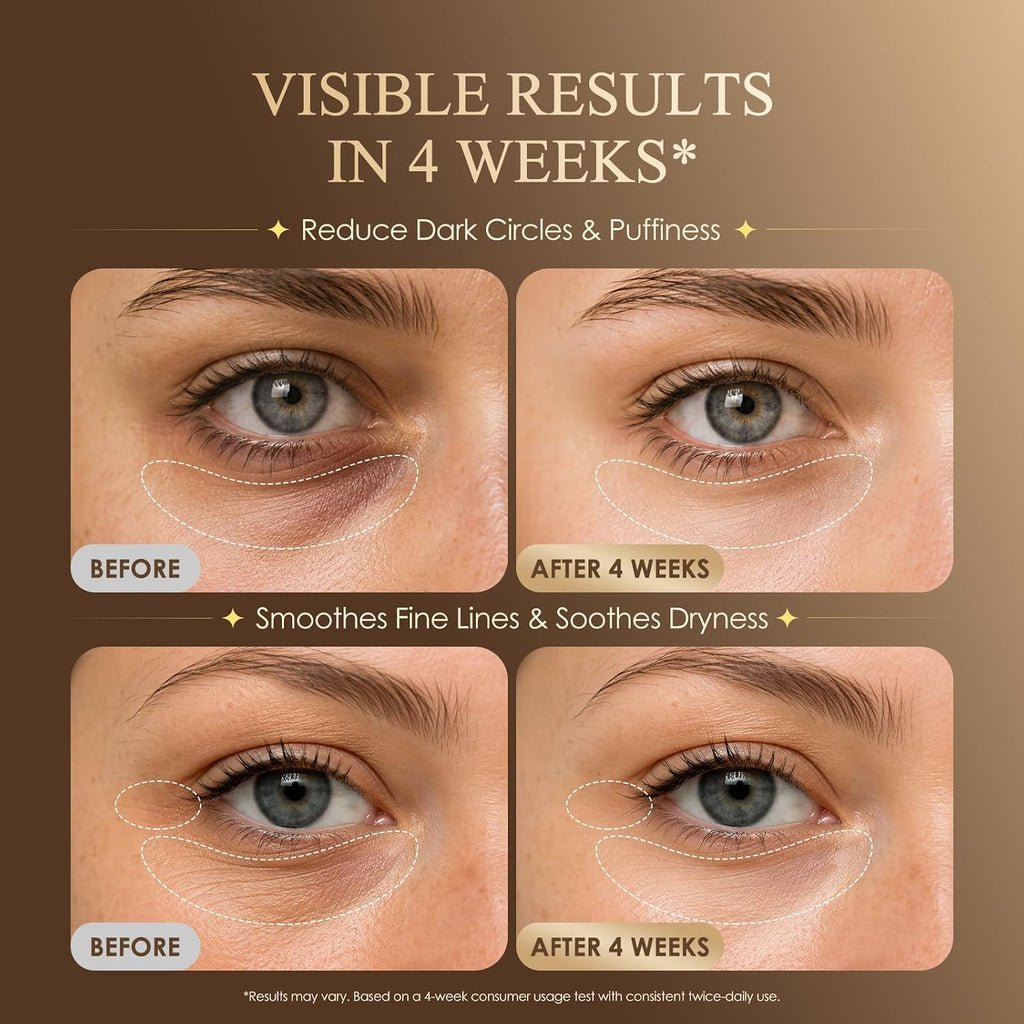 EyeVeil™ — cafeïne-oogserum tegen wallen & vermoeide ogen