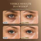 EyeVeil™ — cafeïne-oogserum tegen wallen & vermoeide ogen